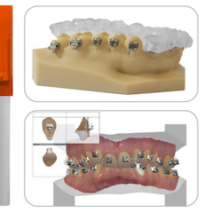EnvisionTEC Debuts New Dental 3D Printing Material for Custom Trays