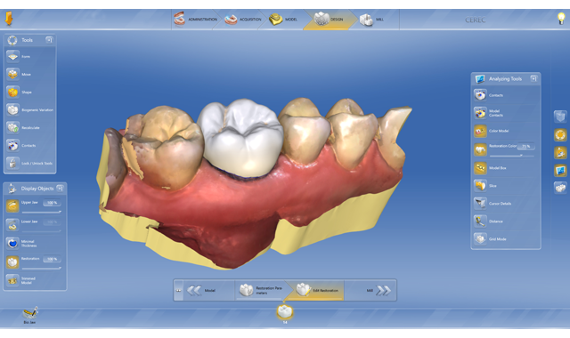 Dentsply Sirona CAD/CAM to present new CEREC SW 4.5 at IDS