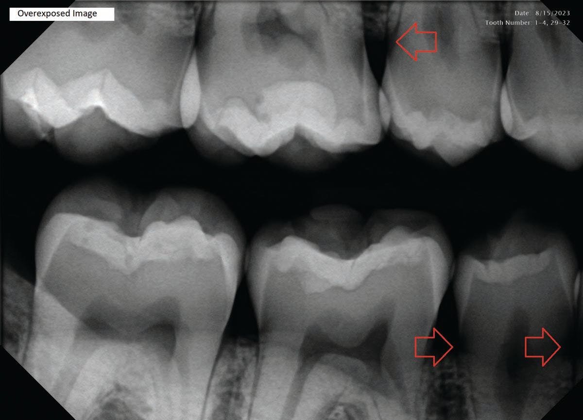 Correct These 3 Mistakes to Take Better X-Rays | Image Credit: © DentiMax