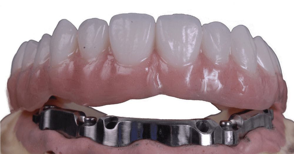 Planmeca, CAD/CAM, Opportunities Are Endless With Digital Dentistry