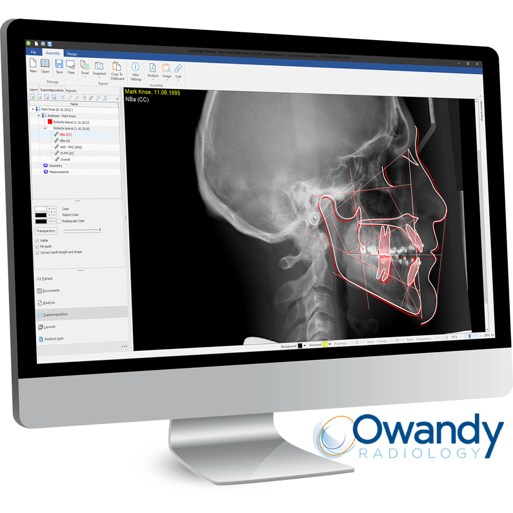 Owandy to Showcase New AI-Powered Ceph Analysis Orthodontic Software at CDS Midwinter