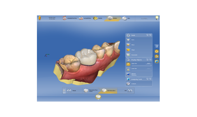 Dentsply Sirona launches CEREC Software 4.5
