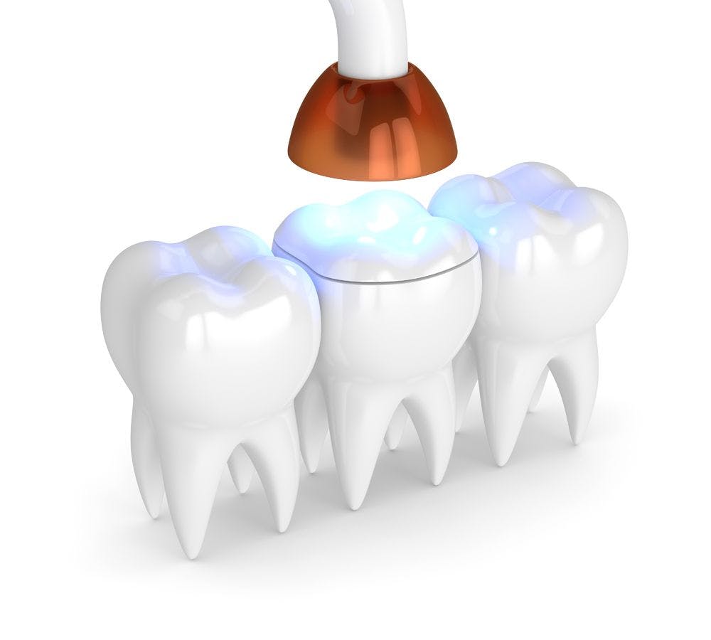 Wireless dental curing light LED, 3D rendering