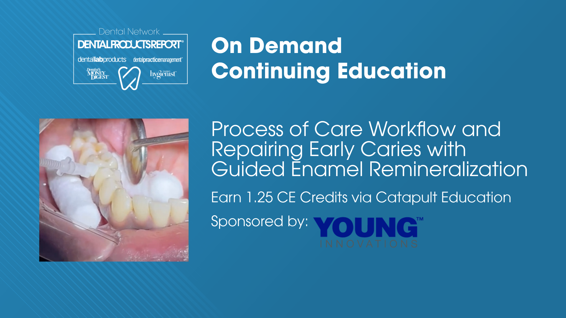 Process of Care Workflow and Repairing Early Caries with Guided Enamel Remineralization