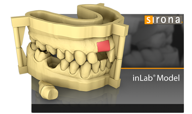 Dentsply Sirona releases inLab SW 18