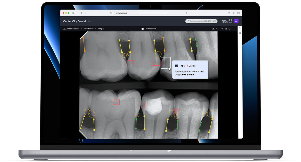 This Group Practice Utilizes VideaHealth Dental AI Technology on Every Patient | mage Credit: © VideaHealth