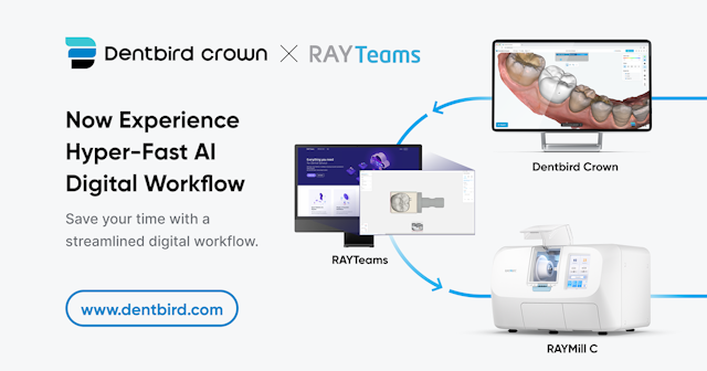 Dentbird Crown and RAYTeams Now Integrated to Enhance Digital Dentistry | Image Credit: © Imagoworks, Inc