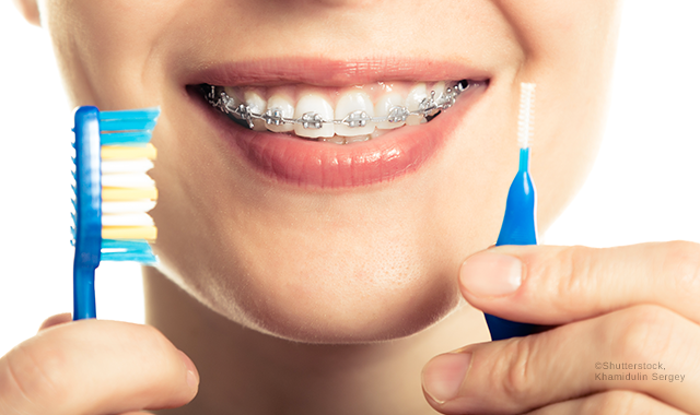 7 ways to promote oral health during orthodontics