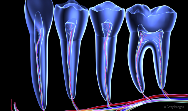 Scientists develop material to rebuild enamel, decrease tooth sensitivity