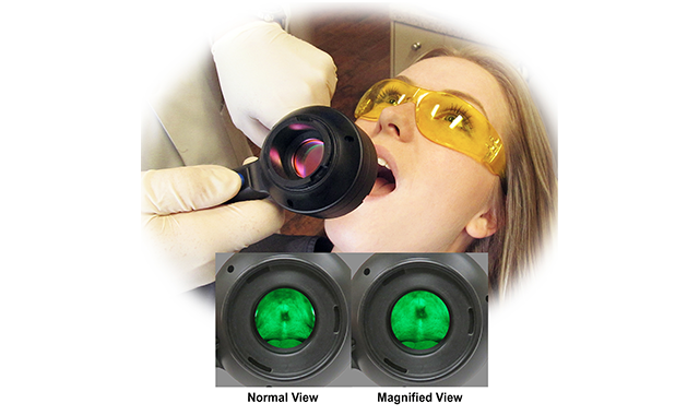 New AdDent eyepiece magnifies abnormalities
