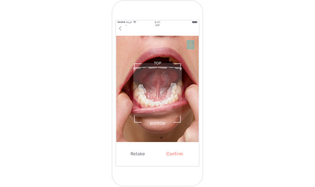 Toothpic smartphone app to deliver expert dental advice