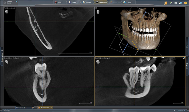 Dentsply Sirona releases Sidexis 4 V 4.3 and updates Orthophos SL