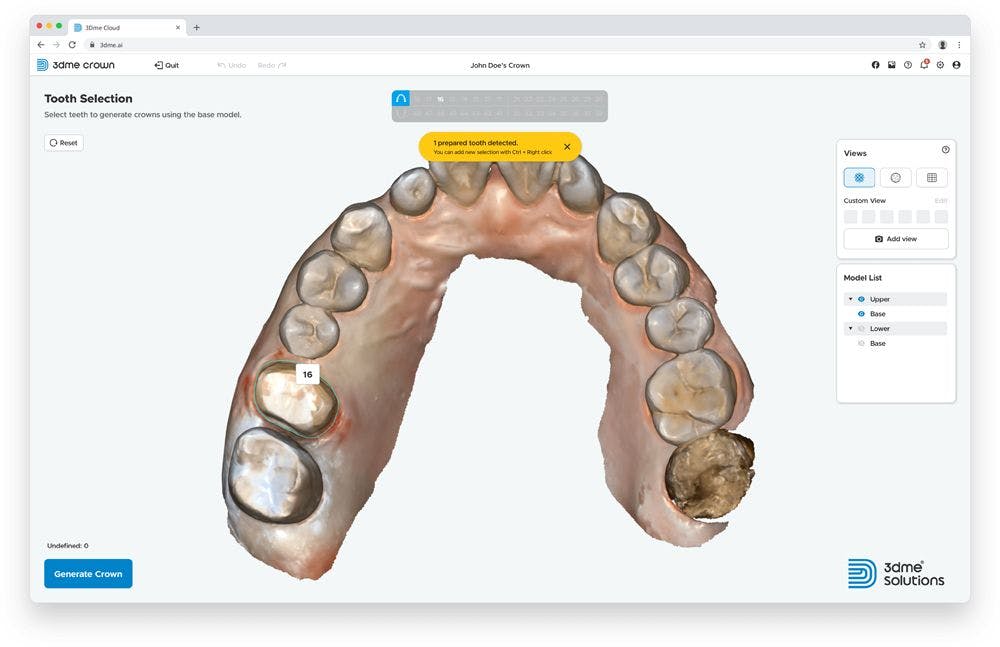 Digital tooth selection software