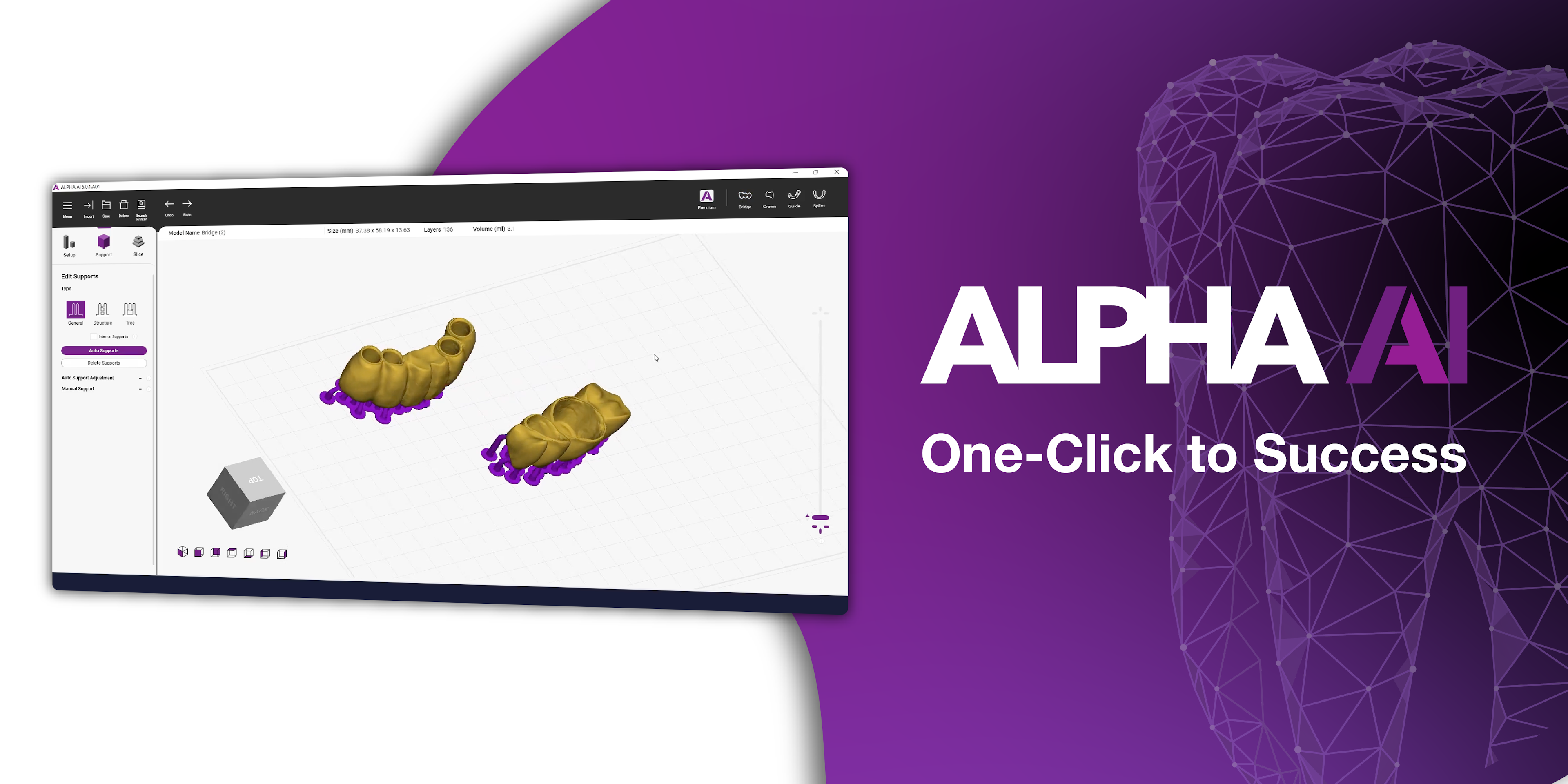 Ackuretta Introduces ALPHA AI 3D Slicing Software