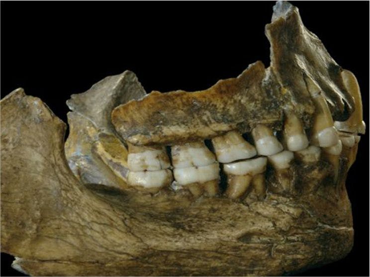 5 Amazing Things Anthropologists Learned from Teeth