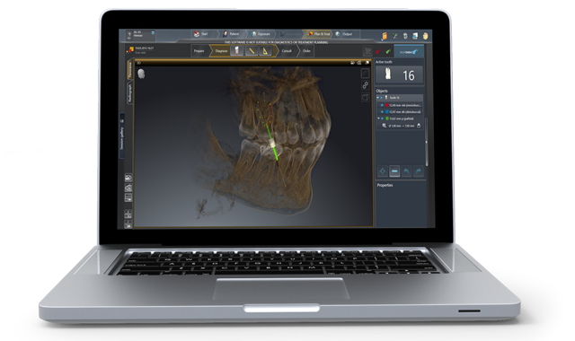 Dentsply Sirona introduces SICAT Endo 3D software