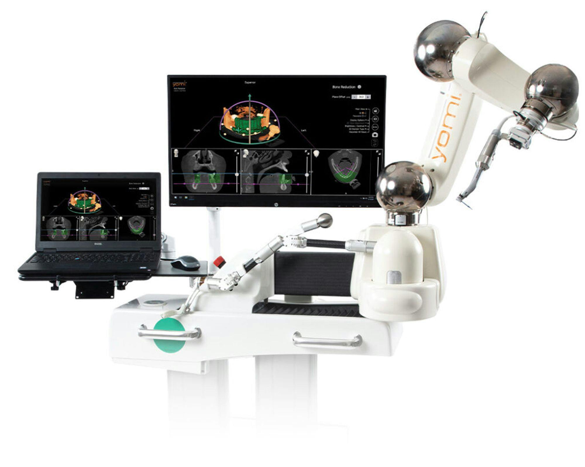 Neocis Launches New Bone Reduction Feature for Yomi Robot | Image Credit: Neocis