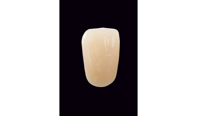 VITA launches new generation of denture teeth with VITAPAN EXCELL