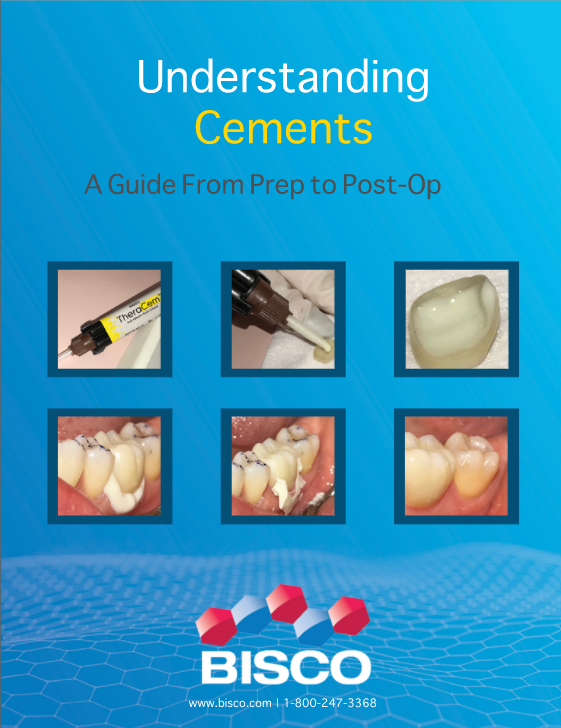 Understanding Cements: A Guide From Prep to Post-Op