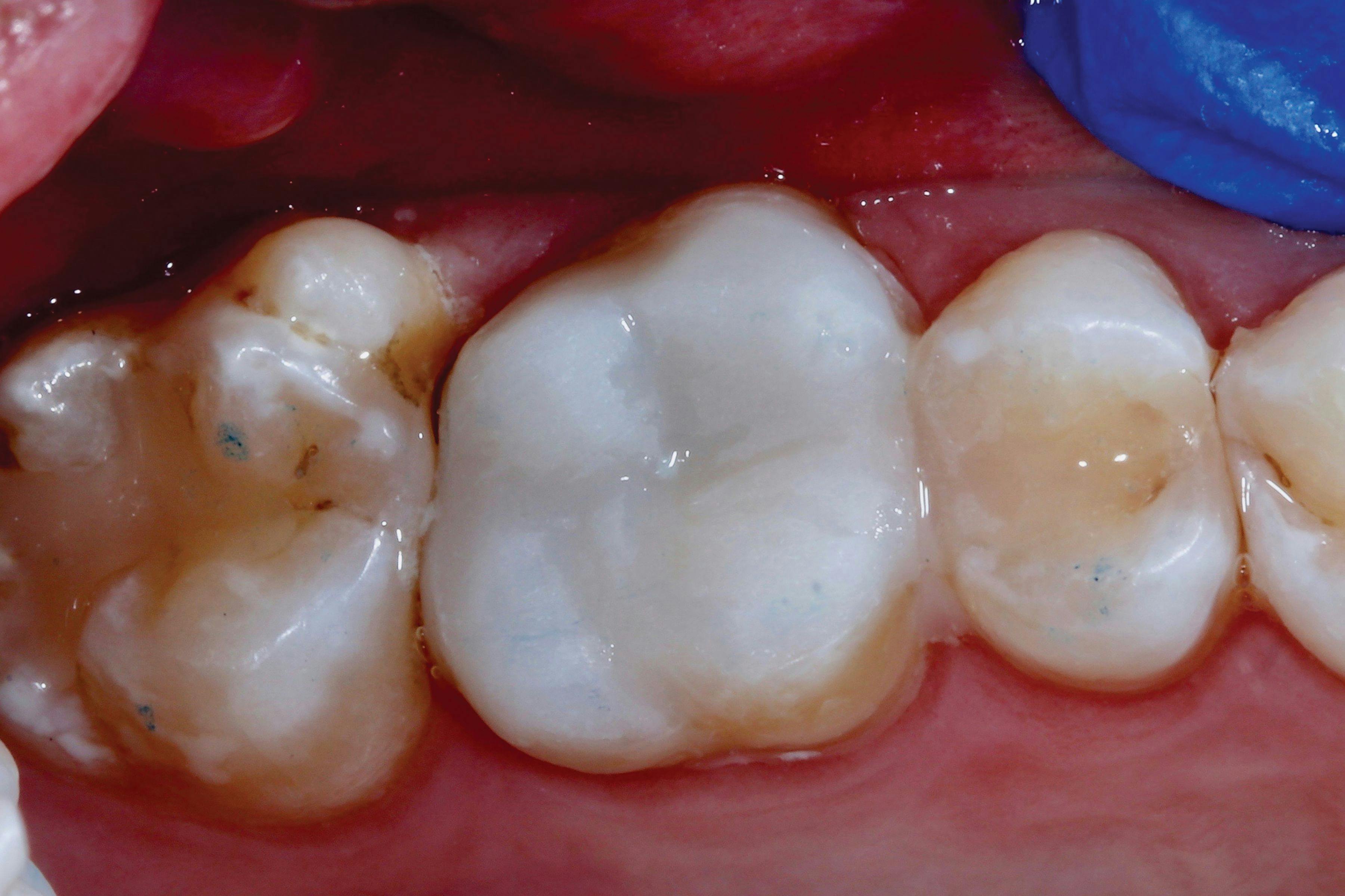 How to deliver optimal care with the right restorative essentials