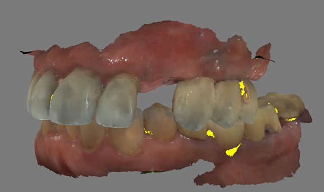 How to create esthetic results using digital dentistry