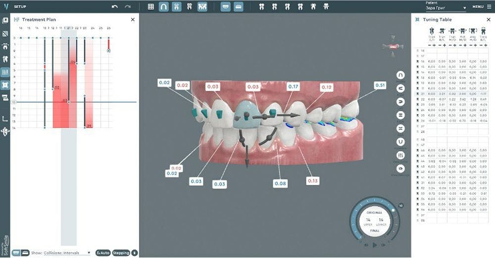 Candid has announced a new strategic partnership with orthodontic software company SoftSmile.