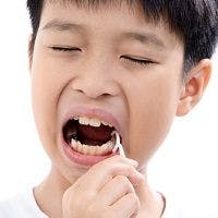 Don't Believe the Hype: Dental Groups Say Flossing Still Essential