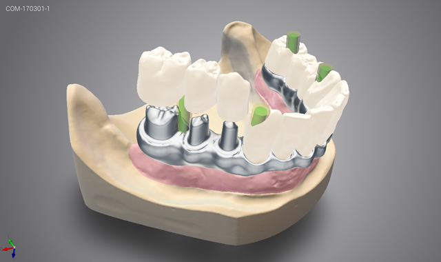 Dental Wings launches DWOS 7.0 update