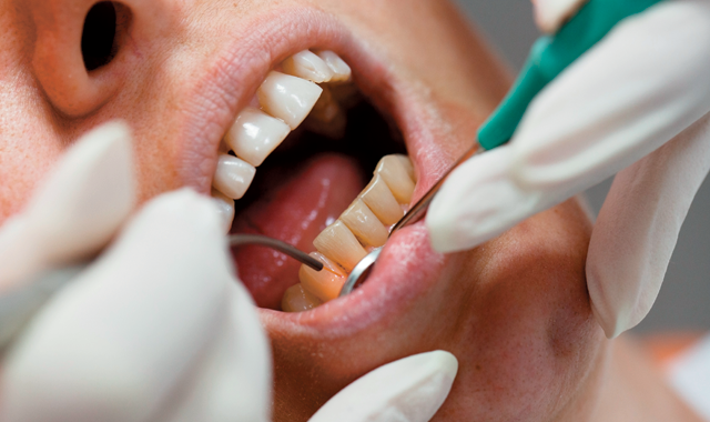 Choosing a dental laser for your practice