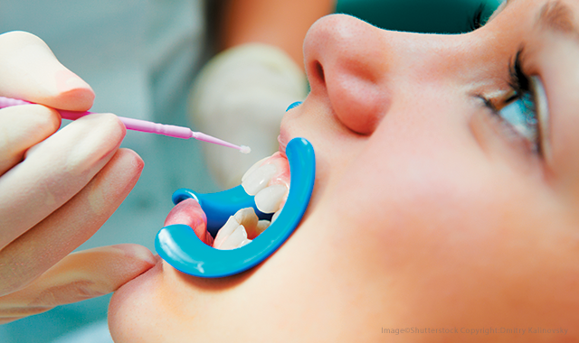 Achieving optimal oral health with preventive care products