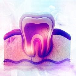 Alzheimer's Drug Could Change How Dentists Treat Large Cavities