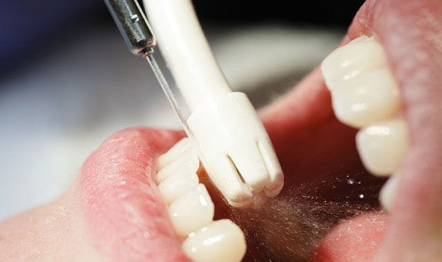 Saliva plays key role in caries prevention