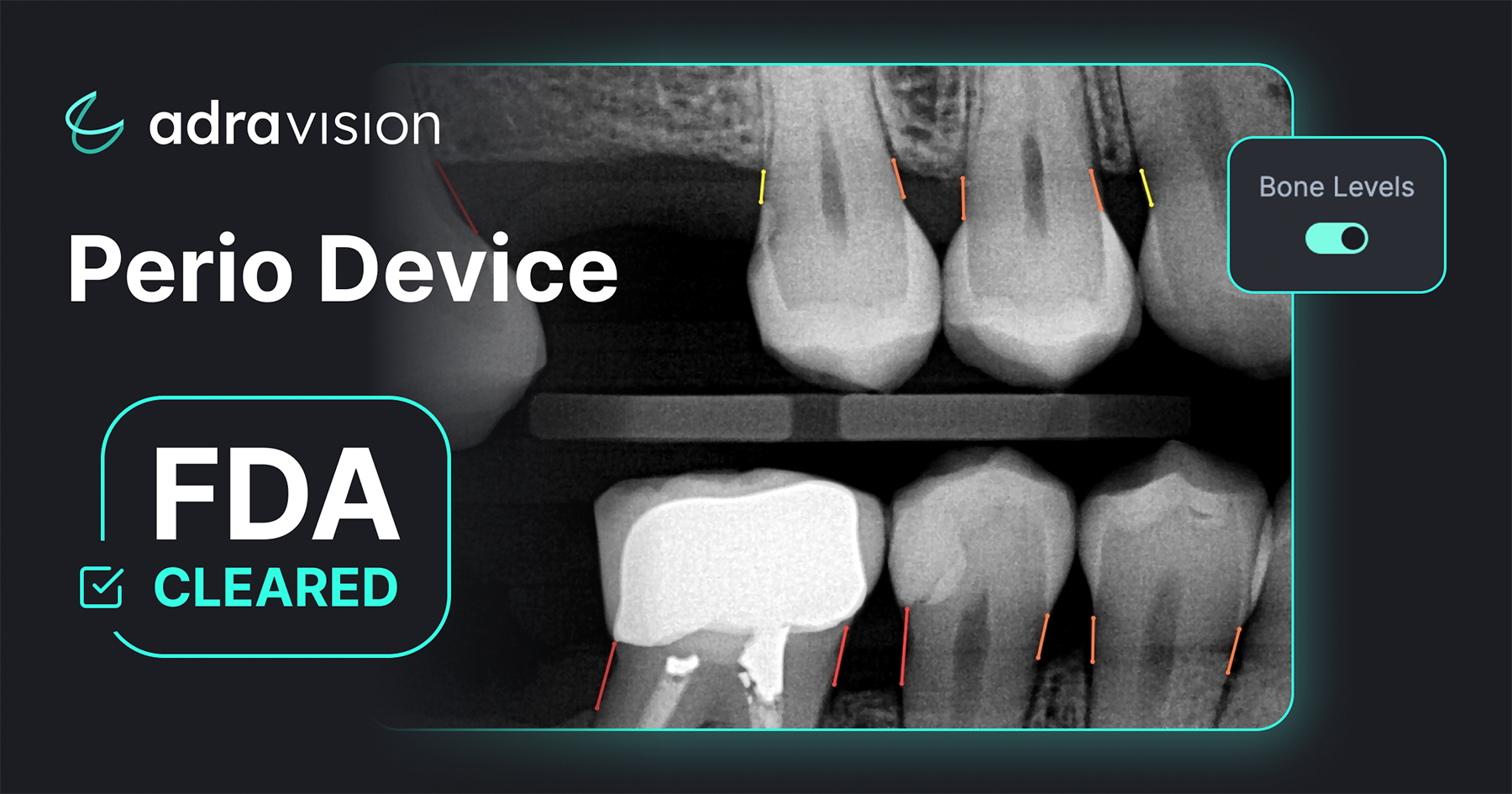 Adravision Secures FDA Clearance for AI-driven Dental Image Enhancement Technology | Image Credit: © Adravision