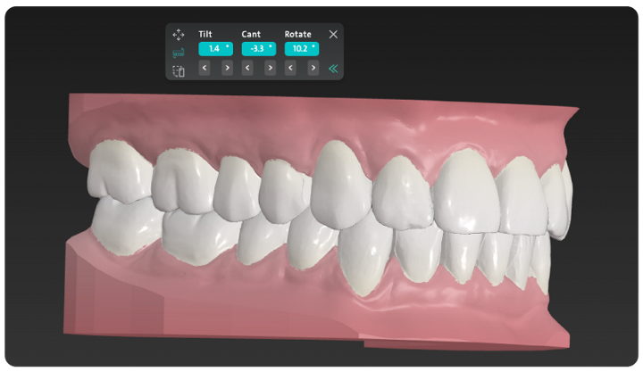 ClearCorrect Orthodontic Digital Workflow | Image Credit: © ClearCorrect