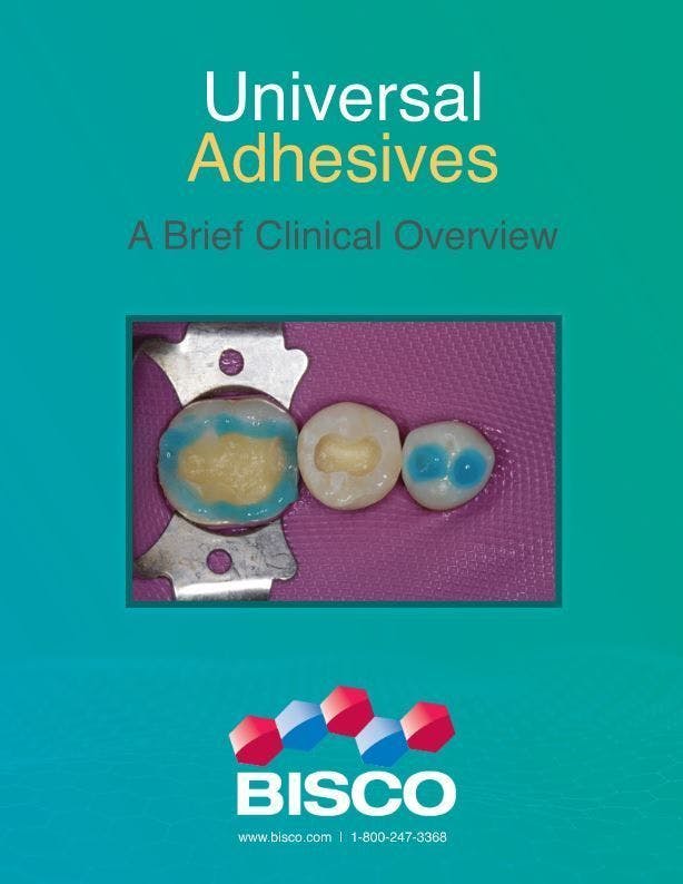 Universal Adhesives: A Brief Clinical Overview