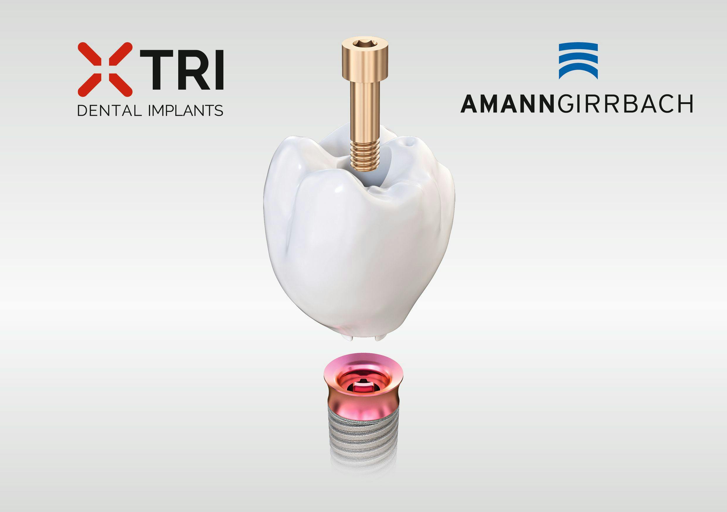 matrix implant from Amann Girrbach and TRI Dental Implants