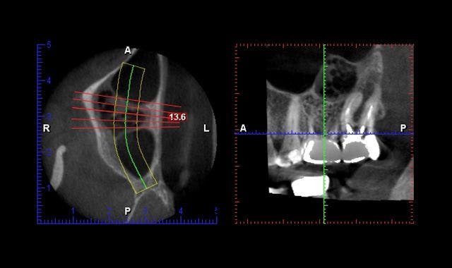 The 5 most commonly asked questions about CBCT