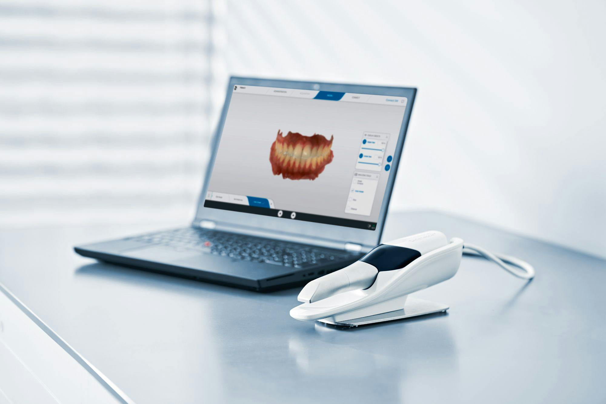 Dentsply Sirona Launches Primescan Connect Laptop-Based Solution. 