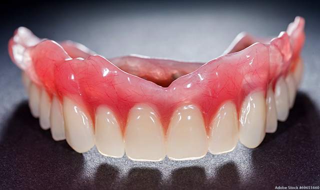 What you need to know about the evolution of dentures