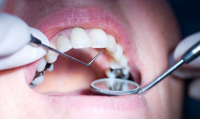 How to navigate the new periodontal classification system