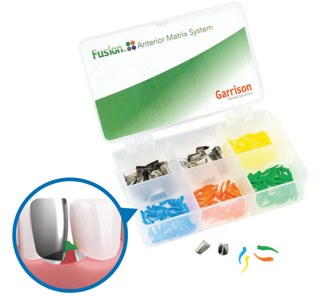 Fusion Anterior Matrix System from Garrison Dental Solutions
