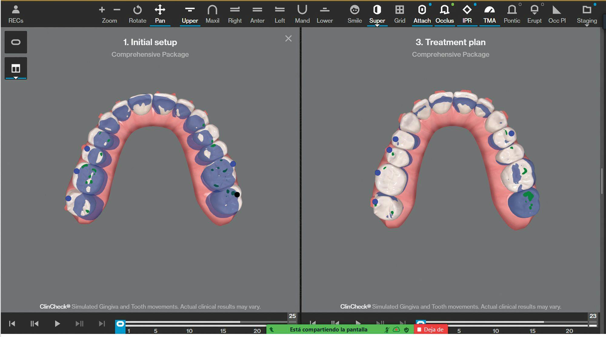 The Expanding Pool of Clear Aligners