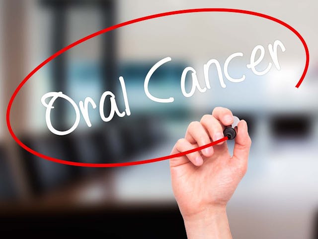 Oral Cancer Screenings Can Save Lives | Image Credit: © Netsay - stock.adobe.com