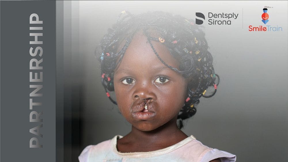 Dentsply Sirona, Smile Train Partnering Up to Support Cleft Care for Children