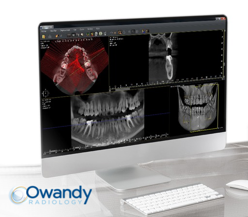 Owandy Adds New Updates to QuickVision CBCT Software 