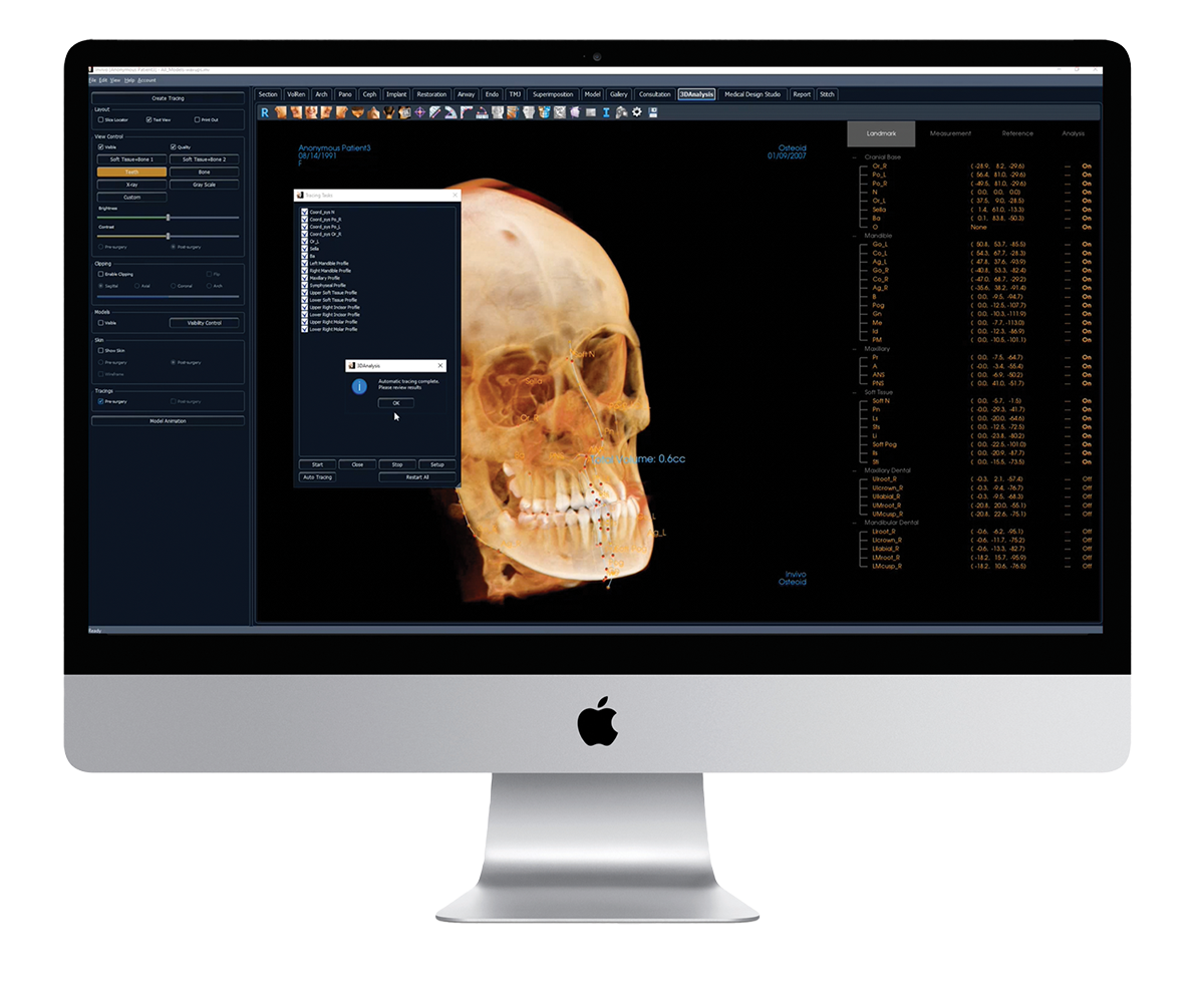 Osteoid Inc. has released the latest version of Invivo, the company's 3D treatment planning software for dentists