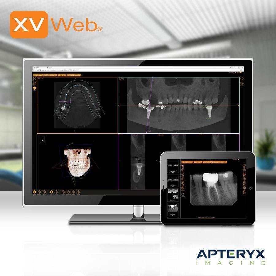 Technology Insights: XVWeb from Apteryx