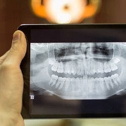 The Costs and Benefits of a Digital Dental Workflow