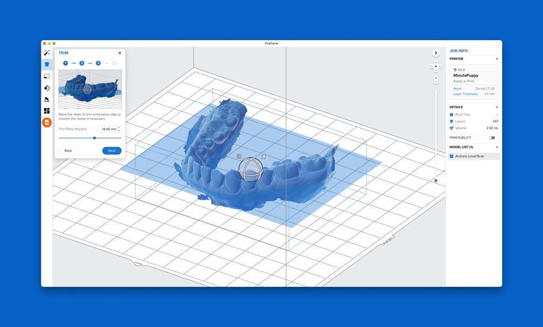 Formlabs’ New Scan to Model Feature for PreForm Software Eases Entry into Digital Dentistry