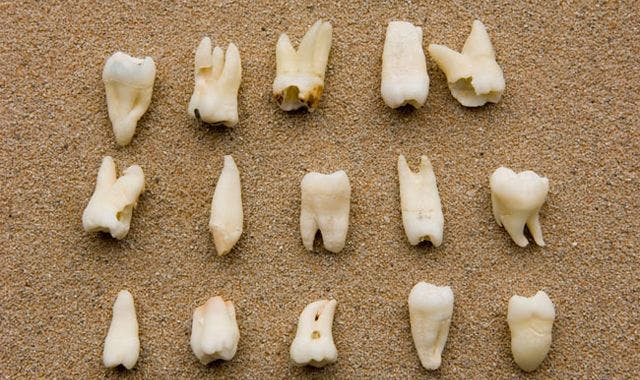 New test helps law enforcement predict criminal’s age based on teeth samples